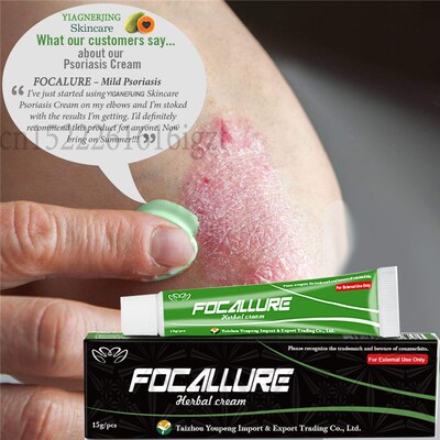 NO BOX YIGANERJING FOCALLURE Body Psoriasis Cream Dermatiti