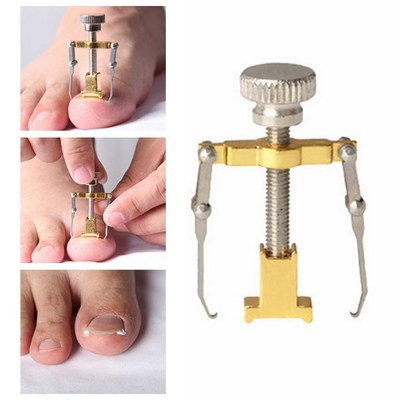 Nail-Recover-Tool Pedicure Ingrown Toenail Foot-Care Nail-Na