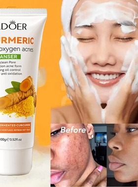 turmeric face cleanser wash gel blackhead acne spot洗面奶乳