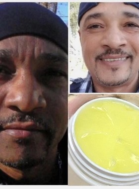 Super Skin Lightener Cream Vitamin E Para Piel Morena face