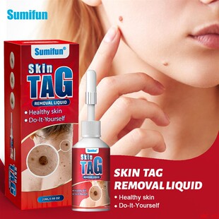 skin tag removal liquid healthy cream尤瘊外用保健液皮肤护理
