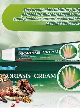Psoriasis cream Skin Ringworm Net Cream Anti-itch Ointment