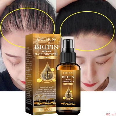 Ginger Hair Fast Growth Serum Spray Biotin Anti Hair Loss