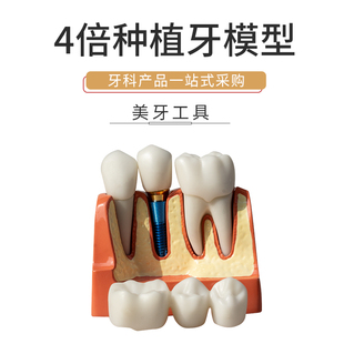 4倍种植解说模型 牙冠可拆卸种植钉展示模型 医患沟通 口腔牙模型