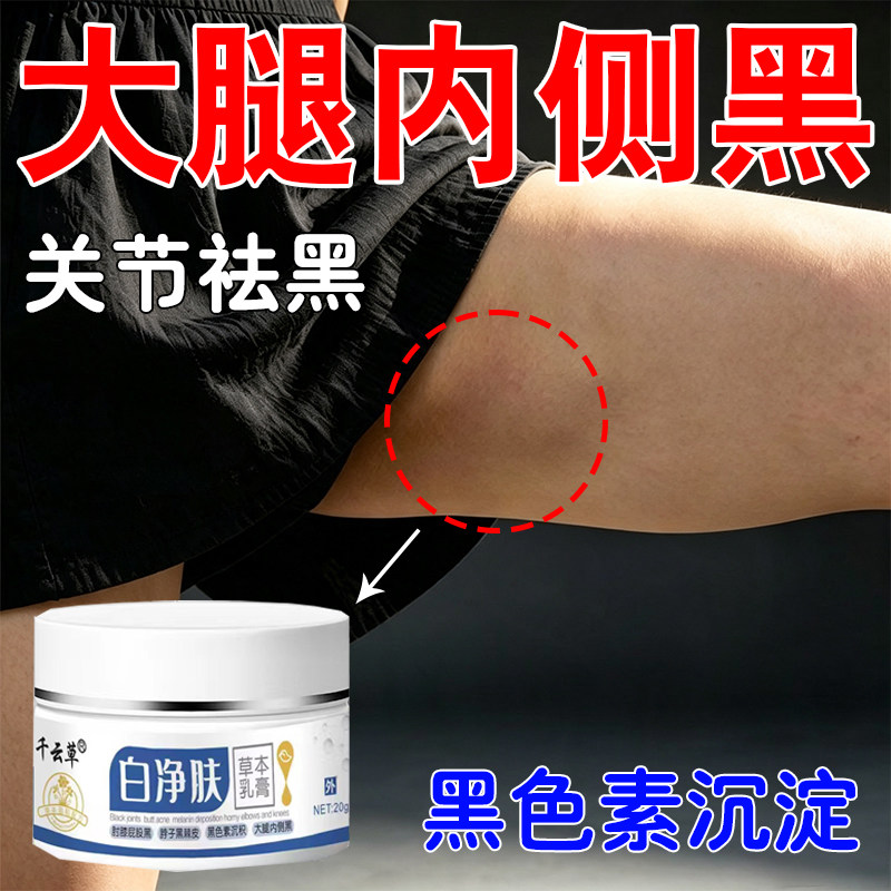 大腿内侧黑黑皮棘色素沉晒淀黑脖子黑洗黑不掉修复去黑去黑色除素