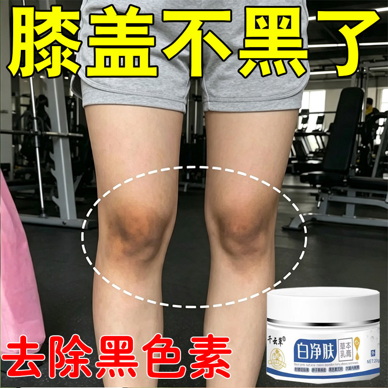 膝盖黑色素沉晒淀黑大腿内侧黑黑皮棘脖子黑洗黑不掉去黑色除素用