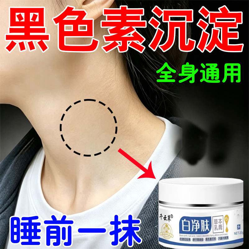 去黑色除素脖子黑色素沉晒淀黑洗黑不掉用黑皮棘大内腿黑侧脖子黑