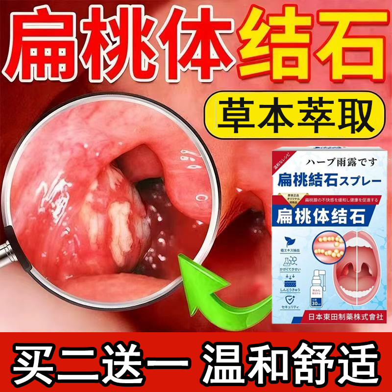 扁桃体结石去除工具隐窝冲洗器清理口腔异物除口臭神器漱口水喷剂,洗护清洁剂/卫生巾/纸/香薰,牙刷/口腔清洁工具,淘宝优惠券,粉丝福利购,淘宝优惠卷