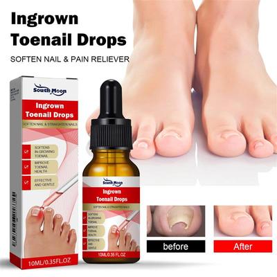 Endogenous nail repair essence 内生趾甲修护精华液去灰指甲