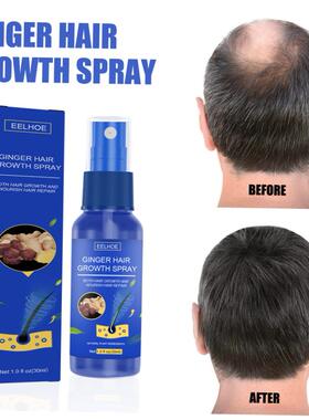 EELHOEGinger Hair Growth Serum Spray Anti Hair Loss Regrowth