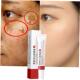 Dark Whitening Spo Remove Melasma Freckle Cream