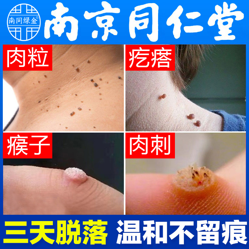 跖疣猴子刺猴瘊子手足脸部专用膏肉粒疙瘩肉刺非药去除尤正品神器