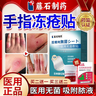 医用手指冻疮贴手冻伤冻疮搭修复膏冬季止痒手足干裂皲裂贴胶布QN