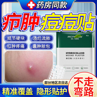 脓包型痘痘贴脸上疖肿火疖子红肿硬块结节毛囊炎痤疮可搭囊肿膏QN