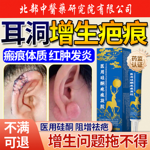 耳洞疤痕增生凸起去除疙瘩硬肉软化瘢痕修复止痒祛除疤药膏YF