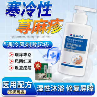 寒冷性慢性丘疹性荨麻疹专用沐浴露儿童提高免疫力断过敏止痒根QN