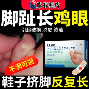 小脚趾长鸡眼贴搭膏药贴专祛用去除脚钉趾老茧贴缝外侧软化肉刺QN