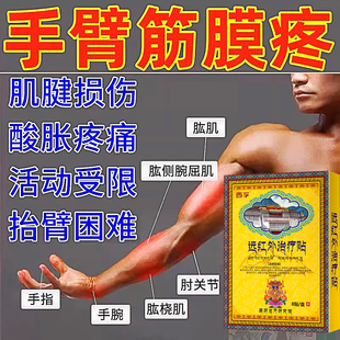 手臂筋膜炎膏药贴肌腱胳膊疼酸痛肌肉拉伤手肘特关节劳损炎效YF