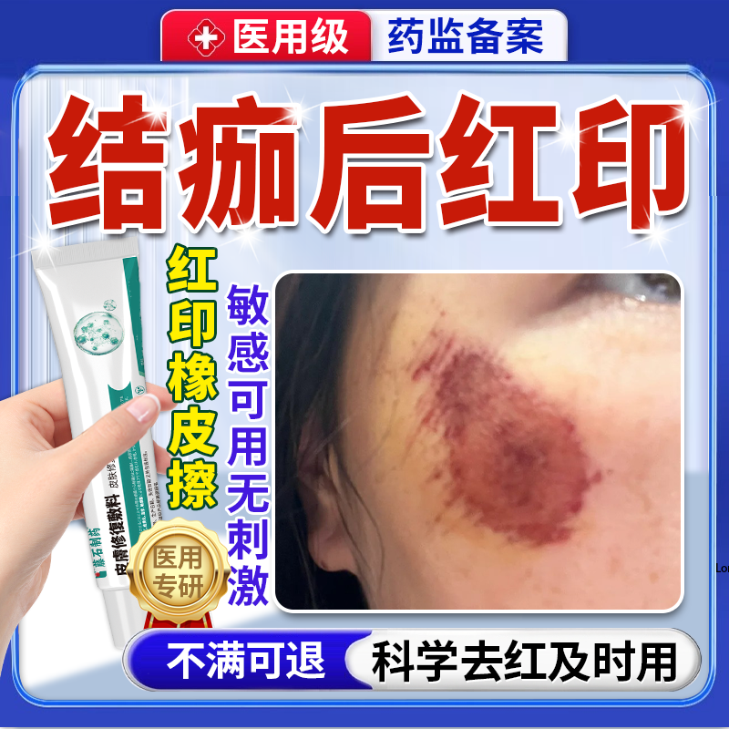 结痂后去红印黑印儿童擦伤摔伤掉痂后除疤痕修复点痣后退红淡印QN
