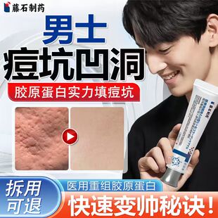 痘印痘坑凹洞修复男士医用型修复膏填充再生淡化祛去搭痘印痘疤QN
