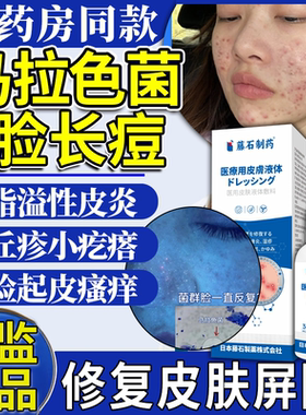马拉色菌脸部螨虫去脸上痘毛囊炎脂溢性皮炎面部非药膏痤疮喷雾QN