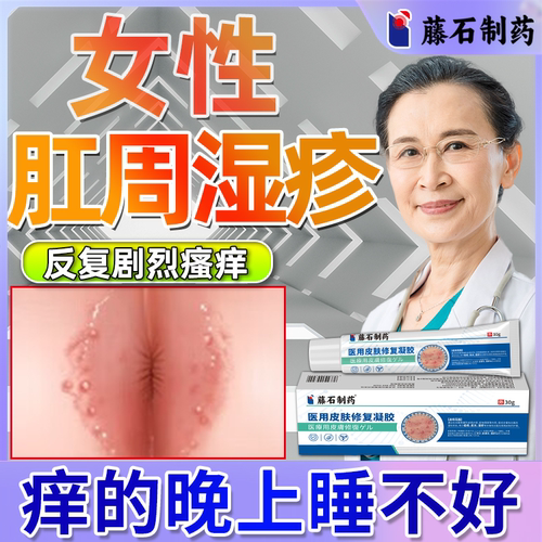 肛周湿疹瘙痒止痒膏潮湿