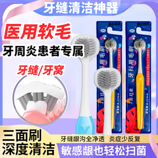 牙刷软毛牙周炎牙齿敏感牙龈肿痛出血萎缩深层洁净专用三面牙刷JQ