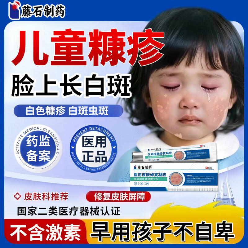 白色糠疹搭药膏儿童脸上长白斑皮肤长癣小孩脸部专汗斑用维生素ZJ