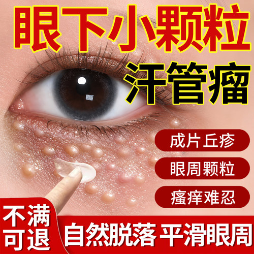 汗管瘤眼部去除神器脂肪粒扁平疣