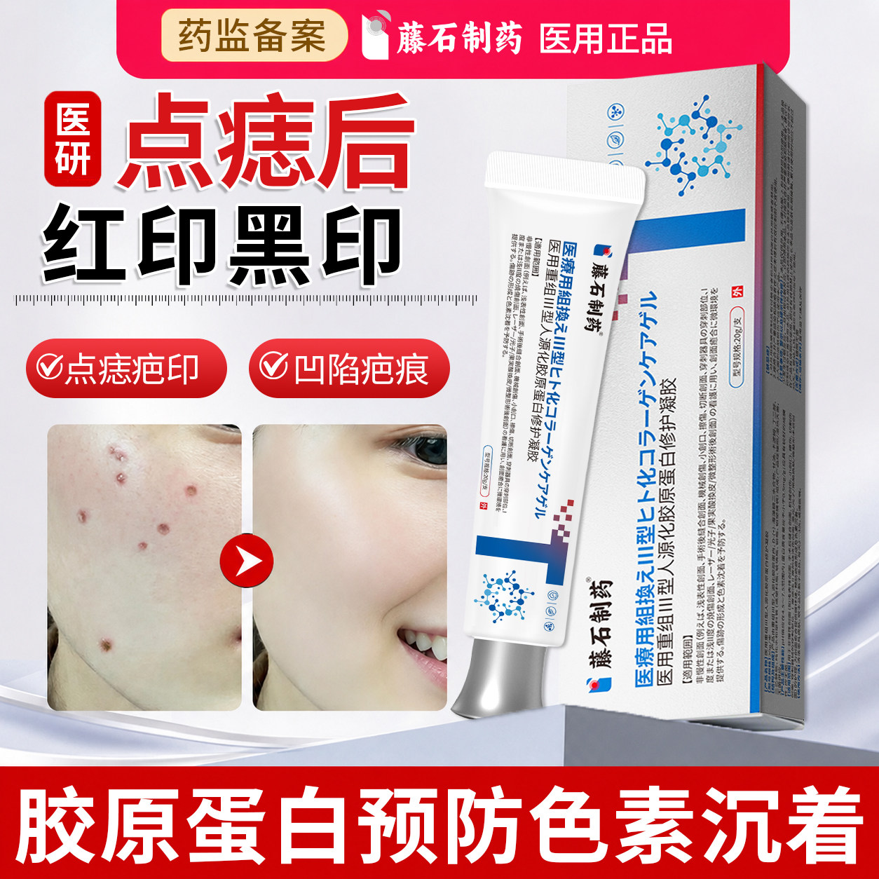 点痣后红印修复膏祛黑印去色素ZJ图片