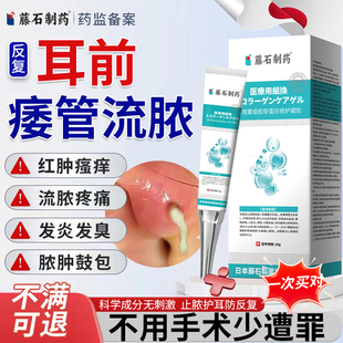 藤石制药耳前瘘管流脓耳仓发炎药监备案膏先天性防水贴清理工具QN