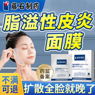 脂溢性皮炎面部面膜脸上鼻翼两侧发红起皮护肤品软膏面部修膜QN