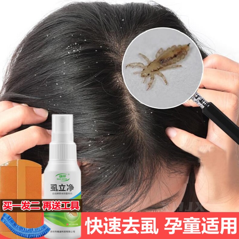 长虱子药杀除狮子药儿童头上小女孩头发蛳子药去虱子卵的治厮子药