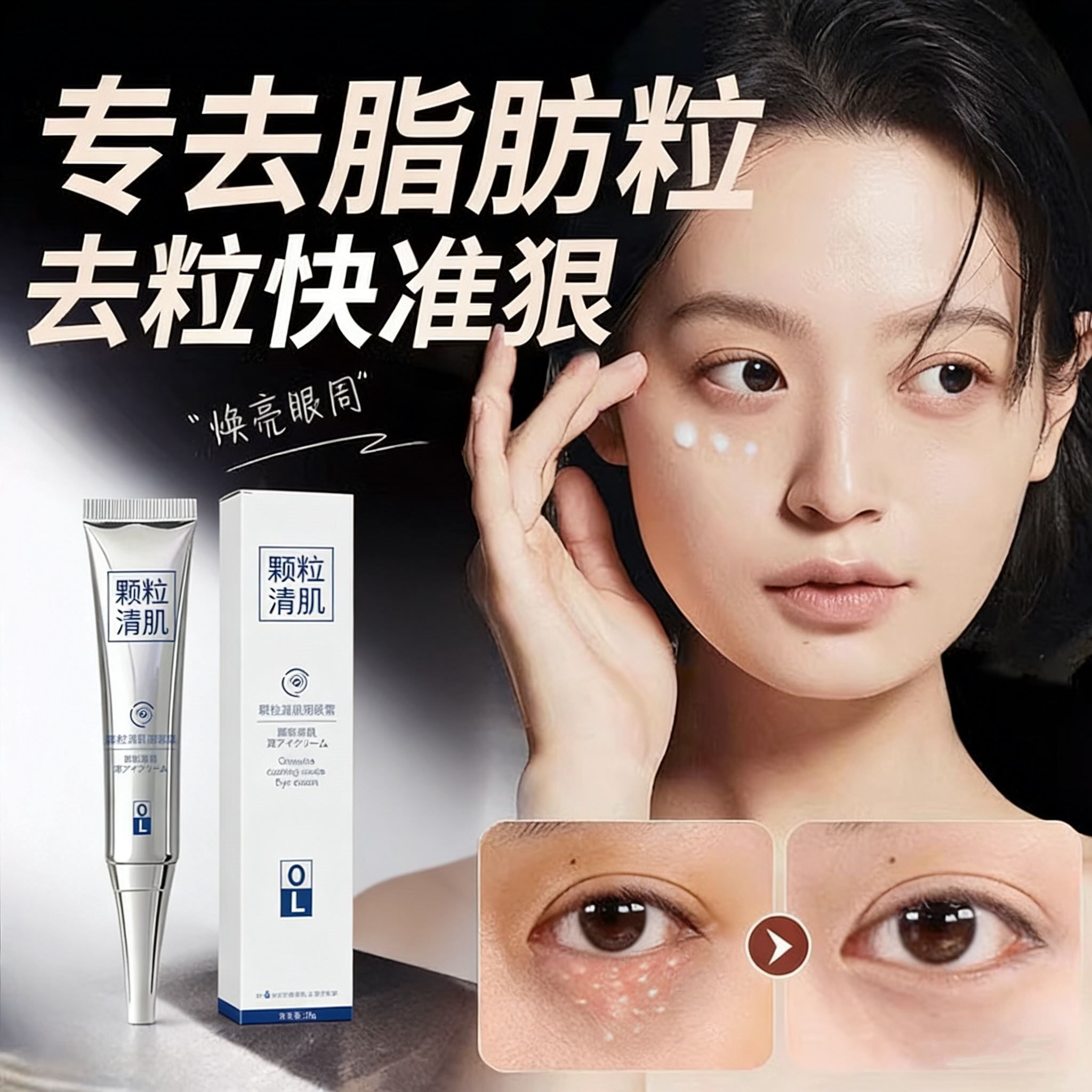 颗粒清肌眼霜眼部祛脂肪粒去除神器眼部汗管粒油粒黑眼圈官方正品