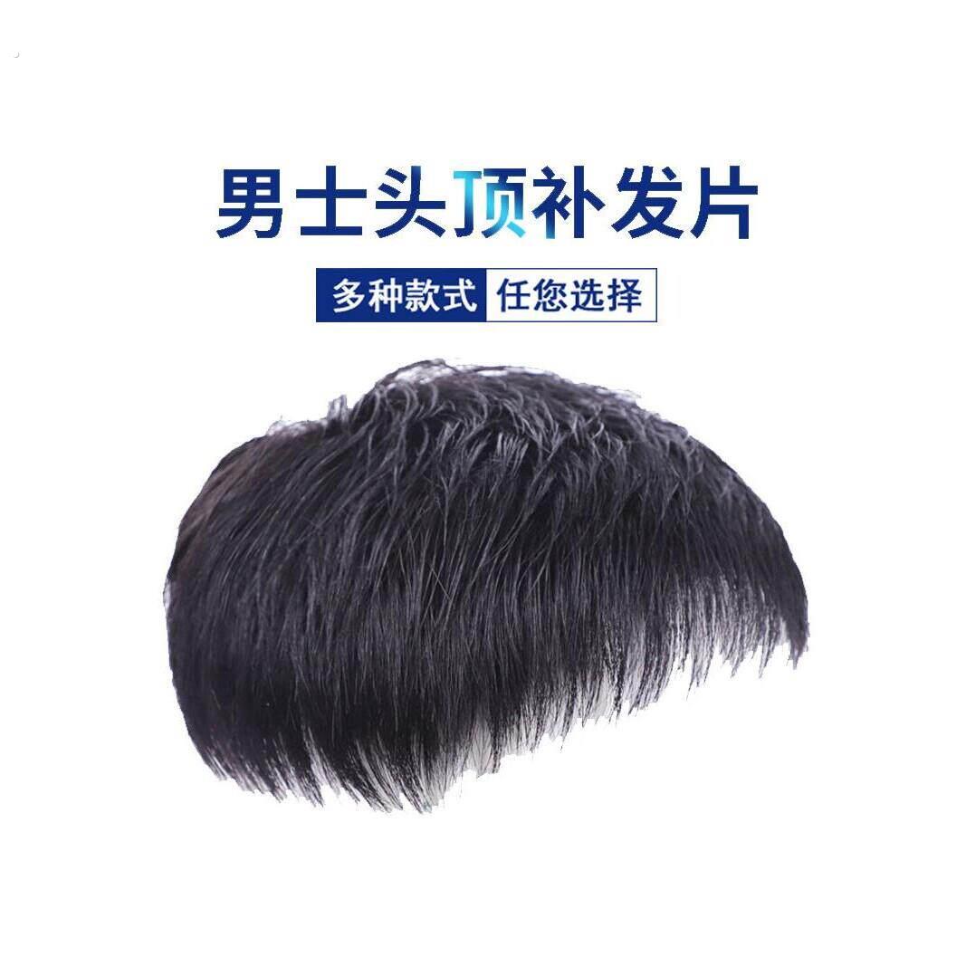 男士补发片假发套头顶补发前额秃顶补发垫接发翻盖假发真发男发块