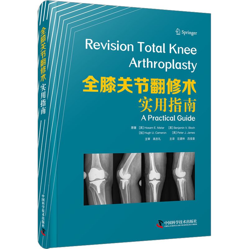 全膝关节翻修术 实用指南(英)霍萨姆·E.马塔尔 等9787523600115书籍\/杂志\/报纸/保健/心理类书籍/家庭医生