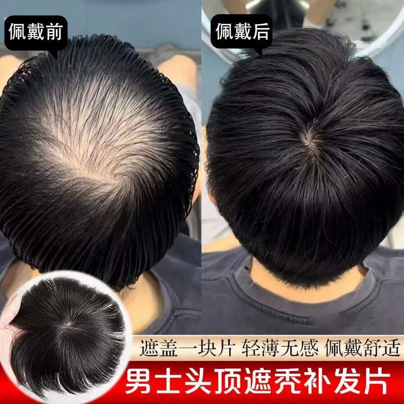男士假发短发全真人发无痕帅气头顶脱发遮地中海秃头男式补发片