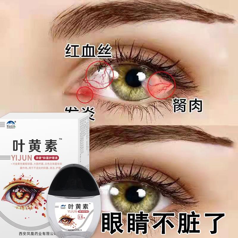 叶黄素滴眼液缓解疲劳干痒涩视线模糊护理液迎风流泪护眼滴眼水
