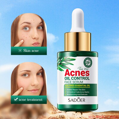 Tea Tree Acne Repair Face Serum Scar Treatment Oil Control液