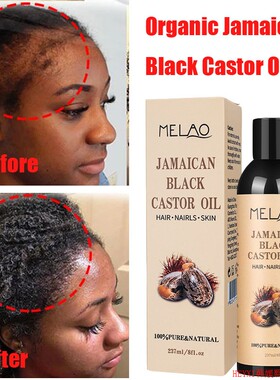Jamaican Organic Black Castor Oil Hair Growth Scalp黑蓖麻油