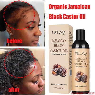 Jamaican Organic Black Castor Oil Hair Growth Scalp黑蓖麻油