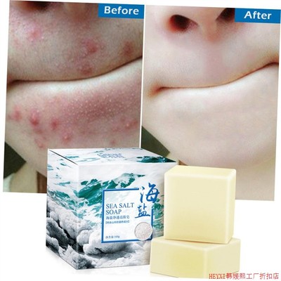 Sea Salt Soap Cleaner Removal Pimple Pores Acne海盐除螨香皂