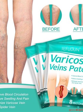 Varicose Veins Patch Spider Veins Veins Pain Relief Patch