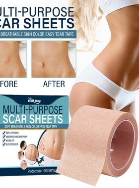 Treatment Sheet Tape Silicone Scar Skin Repair Multi purpose