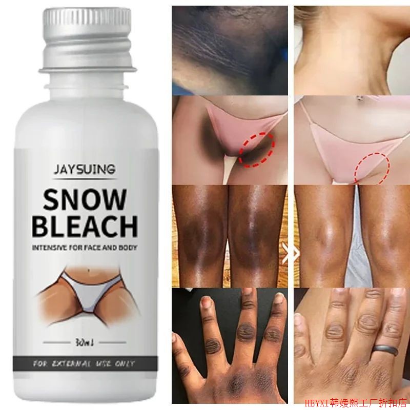 Whitening Cream For Dark Skin Armpit Thigh Inner Joint Light