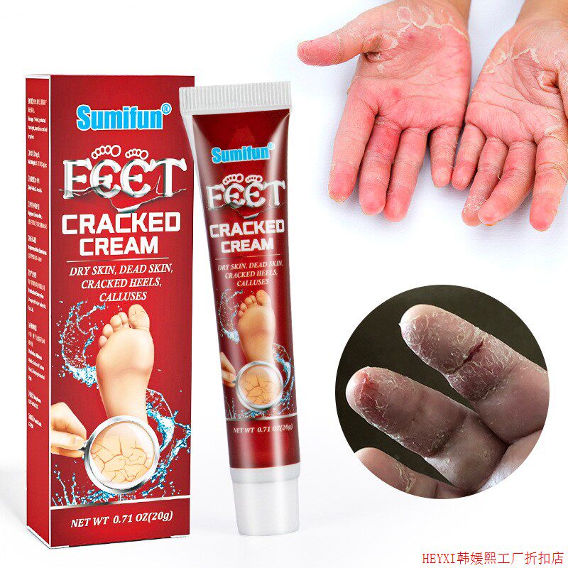 Feet Cracked Cream Feet Dry Crack Anti-freezing Crack Cream