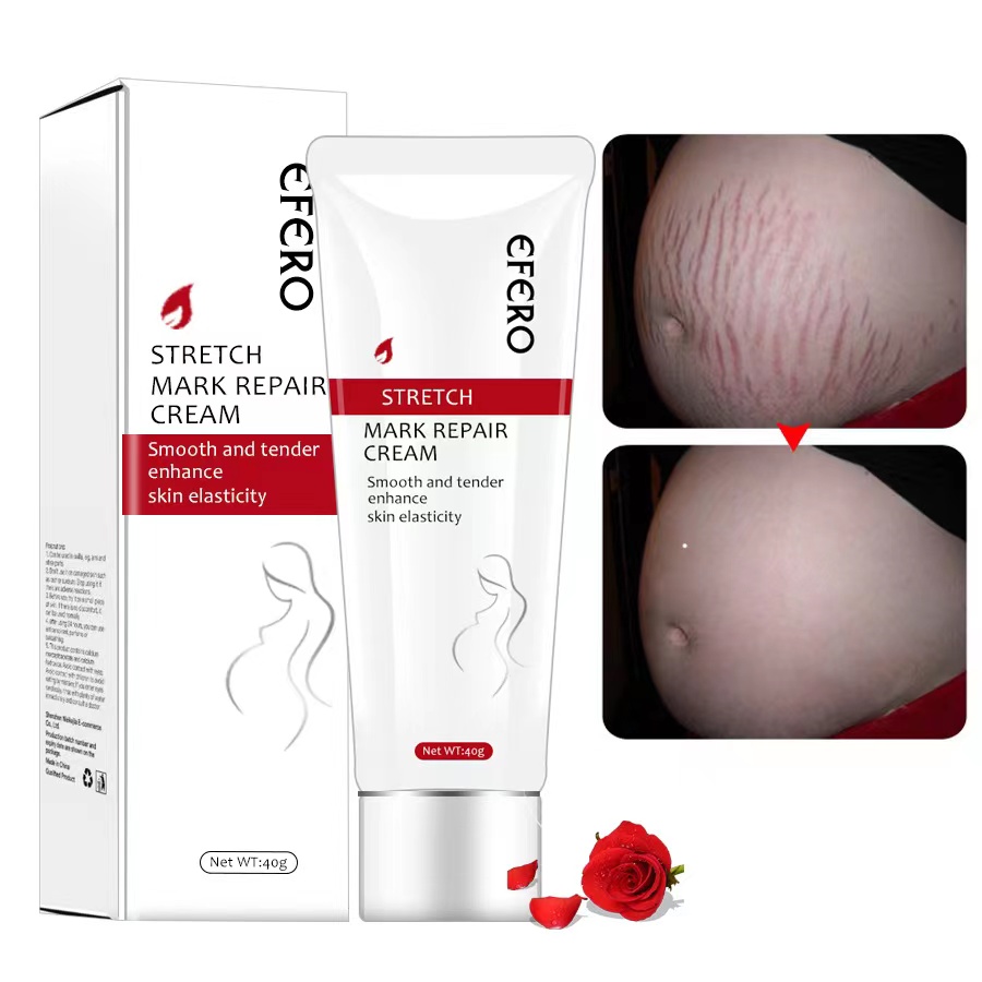 EFERO Lotion Pregnancy cream Pre post-natal Stretch marks