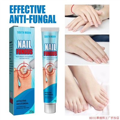 3PCS South Moon NAIL FUNGUS REAPIR PASTE