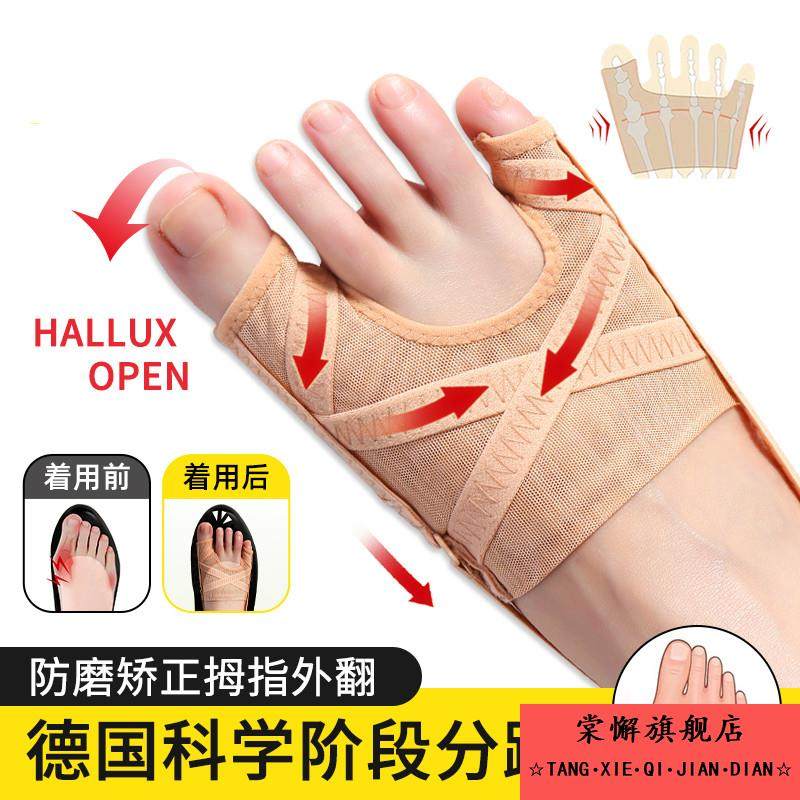 网布拇指外翻大母脚趾双趾小脚趾内翻分趾器纠正大脚骨透气,居家日用,护膝/护腰/护肩/护颈,淘宝优惠券,粉丝福利购,淘宝优惠卷