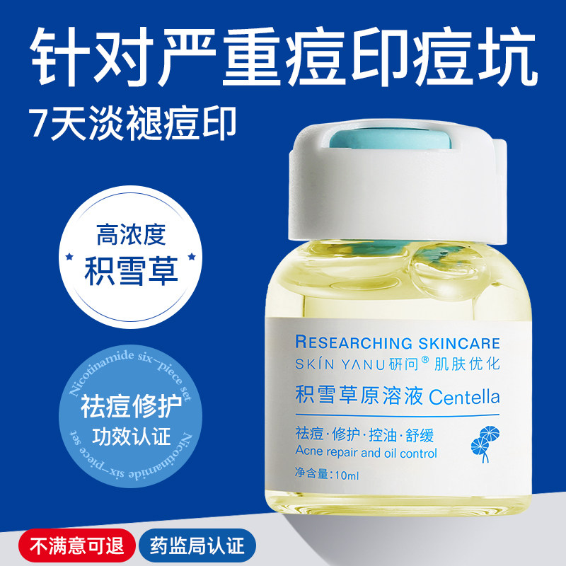 积雪草原液祛痘淡化痘印痘坑去闭口粉刺消印舒缓修复精华液男学生,美容护肤/美体/精油,液态精华,淘宝优惠券,粉丝福利购,淘宝优惠卷